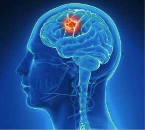 Κάταγμα Κρανίου